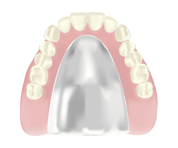 コバルトクロム床義歯