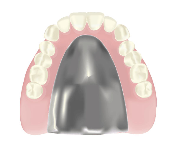 チタン床義歯